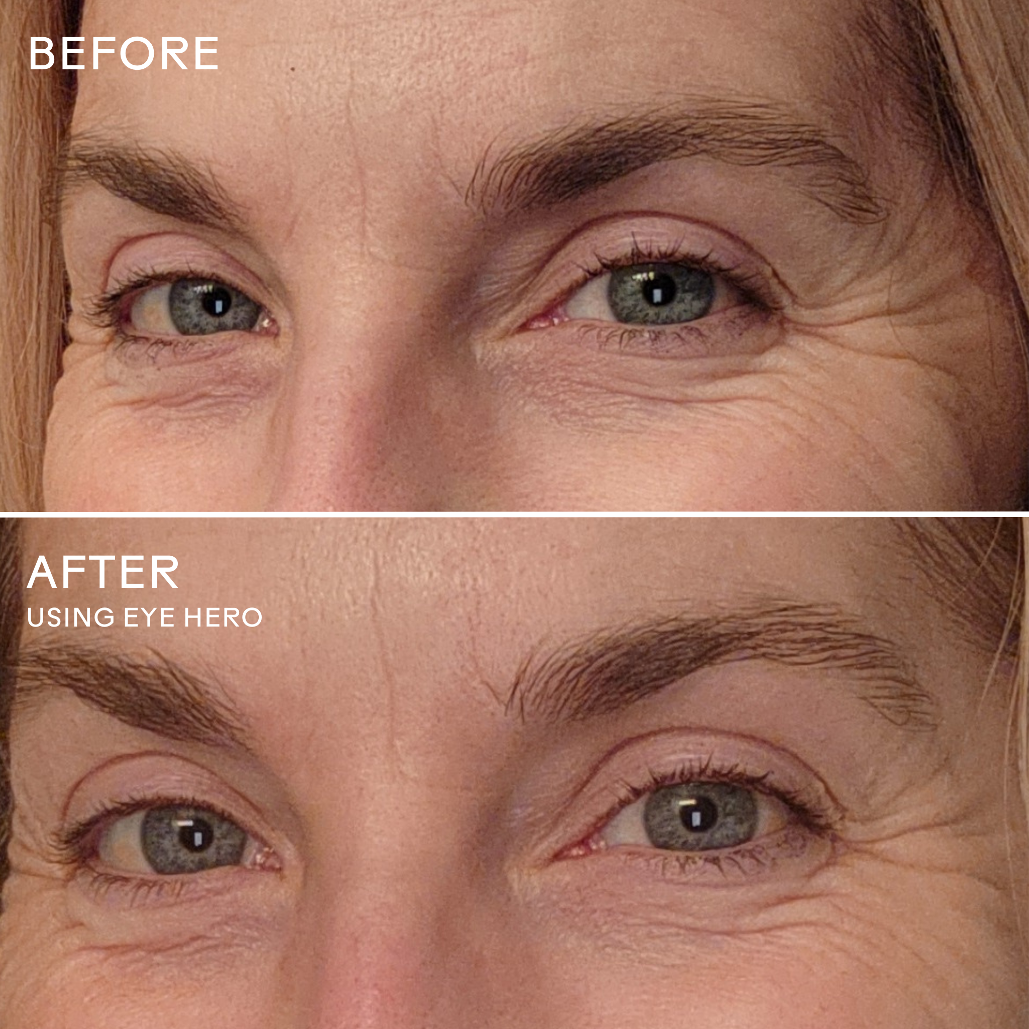 Under-Eye Firming Duo