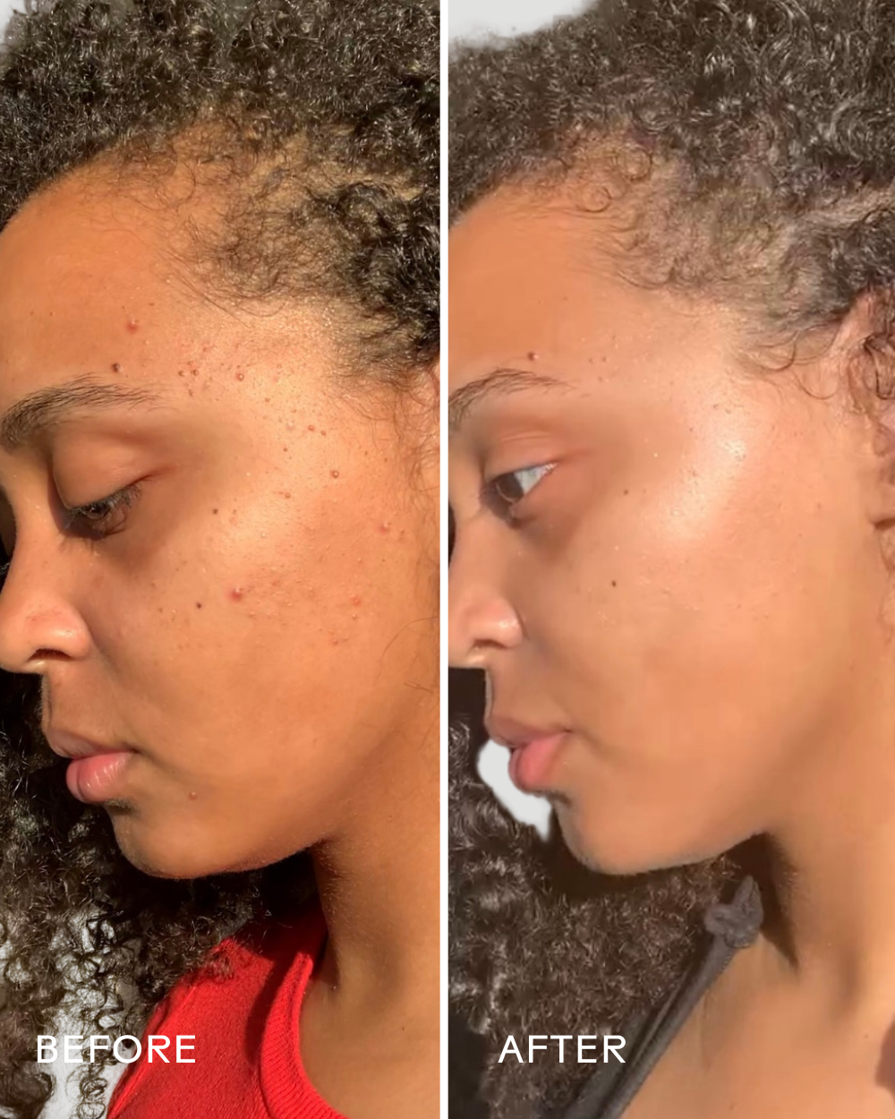 Superfruit™ Lactic + Multifruit 8% AHA Exfoliating Mask